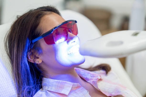Laser Teeth Whitening at Smile Studio Boston